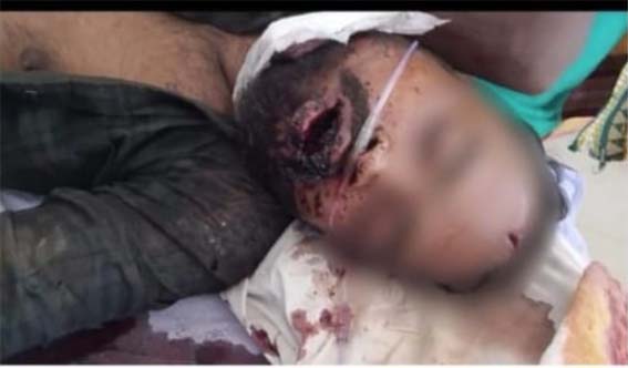 ଜିଭ କାଟି ଯୁବକ କୁ ନିର୍ମମ ହତ୍ୟା